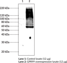 Immunogen: Synthetic peptide from the C-terminal region of human GPR99 • Host: Rabbit • Species Reactivity: (+) Human • Applications: Western blot and IHC