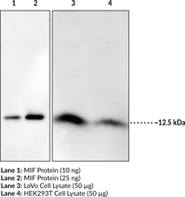 Immunogen: Full-length recombinant human MIF protein • Host: Rabbit • Species Reactivity: (+) Human • Applications: ELISA