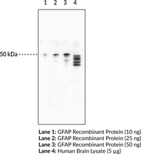 Immunogen: Full length recombinant human GFAP protein • Host: Mouse • Species Reactivity: (+) Human