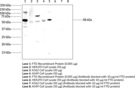 Immunogen: Recombinant human FTO protein • Host: Rabbit • Species Reactivity: (+) Human •  Applications: ELISA