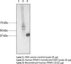 Immunogen: Recombinant human PINK1 amino acids 156-511 • Host: Mouse • Species Reactivity: (+) Human