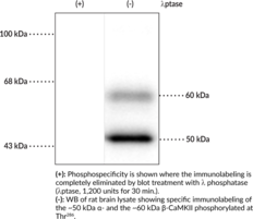 Immunogen: Phosphopeptide corresponding to amino acid residues surrounding phospho-Thr286 of rat CaM Kinase II • Host: Rabbit • Species Reactivity: (+) Human