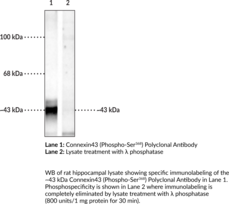 Immunogen: Phosphopeptide corresponding to amino acid residues surrounding phospho-Ser368 of rat connexin43 • Host: Rabbit • Species Reactivity: (+) Mouse