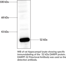 Immunogen: Peptide corresponding to amino acid residues from the N-terminal region of rat DARPP-32 conjugated to KLH • Host: Rabbit • Species Reactivity: (+) Mouse