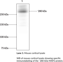 Immunogen: Purified bovine MAP2 • Host: Mouse • Species Reactivity: (+) Human