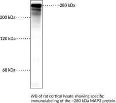 Immunogen: Recombinant bovine MAP2 expressed in E. coli • Host: Chicken • Species Reactivity: (+) Human