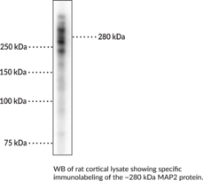 Immunogen: Recombinant human MAP2 expressed in E. coli • Host: Goat • Species Reactivity: (+) Human