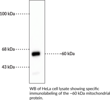 Immunogen: Human mitochondrial homogenate • Host: Mouse • Species Reactivity: (+) Human  • Applications: ICC