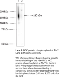 Immunogen: Phosphopeptide corresponding to amino acid residues surrounding the phospho-Thr53 of mouse NCC • Host: Rabbit • Species Reactivity: (+) Human