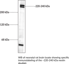 Immunogen: Recombinant partial segment of human nestin expressed in E. coli • Host: Mouse • Species Reactivity: (+) Human