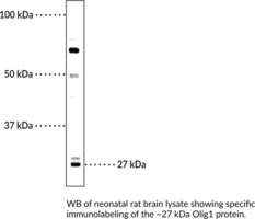 Immunogen: Recombinant mouse Olig1 • Host: Rabbit • Species Reactivity: (+) Human