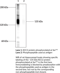 Immunogen: Phosphopeptide corresponding to amino acid residues surrounding the phospho-Ser940 of rat KCC2 • Host: Rabbit • Species Reactivity: (+) Mouse