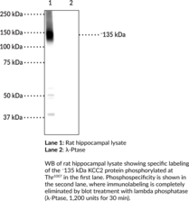 Immunogen: Phosphopeptide corresponding to amino acid residues surrounding the phospho-Thr1007 of mouse KCC2 • Host: Rabbit • Species Reactivity: (+) Mouse