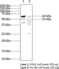 Immunogen: Recombinant human METTL3/14 complex • Host: Mouse • Species Reactivity: (+) Human •  Applications: ELISA