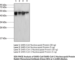 Immunogen: Recombinant SARS-CoV nucleocapsid protein • Host: Rabbit • Species Reactivity: (+) SARS-CoV