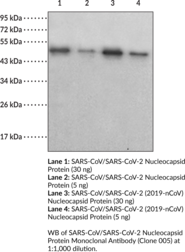 Immunogen: Recombinant SARS-CoV nucleocapsid protein • Host: Mouse • Species Reactivity: (+) SARS-CoV