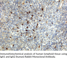 Immunogen: Human IgA • Host: Rabbit • Species Reactivity: (+) Human • Cross Reactivity: (+) Human IgA1