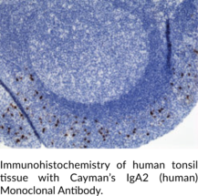 Immunogen: Human IgA2 • Host: Rabbit • Species Reactivity: (+) Human • Cross Reactivity: (+) Human IgA2 (-) Human IgA1