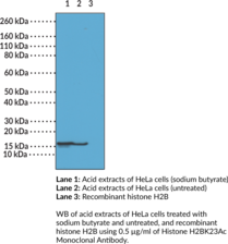 Immunogen: Peptide corresponding to H2BK23Ac • Host: Rabbit • Species Reactivity: (+) Vertebrates • Cross Reactivity: (+) H2BK23Ac; (-) Unmodified H2BK23