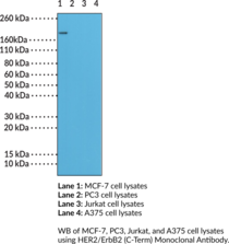 Immunogen: Peptide corresponding to the C-terminal region of human HER2/ErbB2 • Host: Rabbit • Species Reactivity: (+) Human • Cross Reactivity: (+) HER2/ErbB2 • Applications: IHC