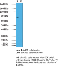 Immunogen: Peptide corresponding to RSK1 (phospho-Thr359/Ser363) • Host: Rabbit • Species Reactivity: (+) Human • Cross Reactivity: (+) RSK1 (phospho-Thr359/Ser363); (-) RSK1 without phosphorylation at Thr359/Ser363 • Applications: IHC