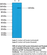 Immunogen: Peptide corresponding to human HIF-1ɑ • Host: Rabbit • Species Reactivity: (+) Human • Applications: IHC