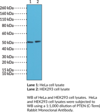 Immunogen: Peptide from the C-terminal region of human PTEN • Host: Rabbit • Species Reactivity: (+) Human • Cross Reactivity: (+) PTEN • Applications: IHC