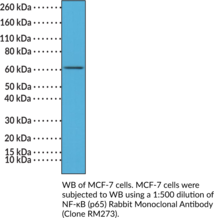 Immunogen: Peptide from the C-terminal region of NF-κB (p65) • Host: Rabbit • Species Reactivity: (+) Human • Cross Reactivity: (+) NF-κB (p65) • Applications: IHC