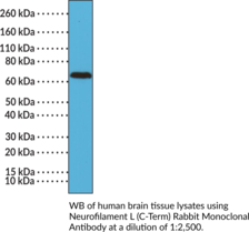 Immunogen: Peptide from the C-terminal region of human neurofilament L • Host: Rabbit • Species Reactivity: (+) Human • Cross Reactivity: (+) Neurofilament L • Applications: IHC