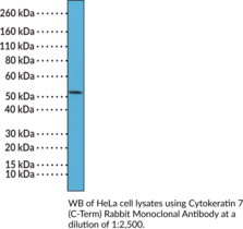Immunogen: Peptide from the C-terminal region of human cytokeratin 7 • Host: Rabbit • Species Reactivity: (+) Human • Cross Reactivity: (+) Cytokeratin 7 • Applications: IHC
