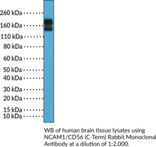 Immunogen: Peptide from the C-terminal region of human CD56 • Host: Rabbit • Species Reactivity: (+) Human • Cross Reactivity: (+) Human NCAM-180