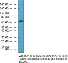 Immunogen: Peptide from the N-terminal region of human PLAP • Host: Rabbit • Species Reactivity: (+) Human • Cross Reactivity: (+) PLAP • Applications: IHC