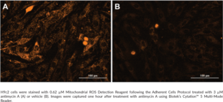 As one of the major sources of reactive oxygen species (ROS) in the cell