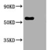 SARS-CoV-2 N Antibody wb