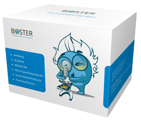 Human Uromodulin/umod PicoKine ELISA Kit