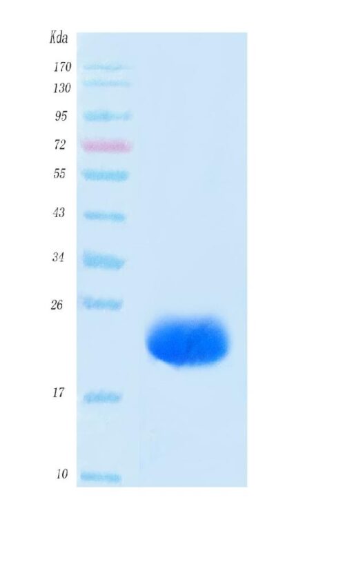 SARS-CoV-2 (COVID-19) NSP8 Protein